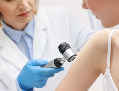 SALUTENEWS: GIORNATA NAZIONALE PER LA PREVENZIONE DEL MELANOMA